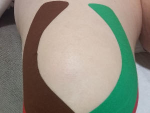 KINESIOTAPING